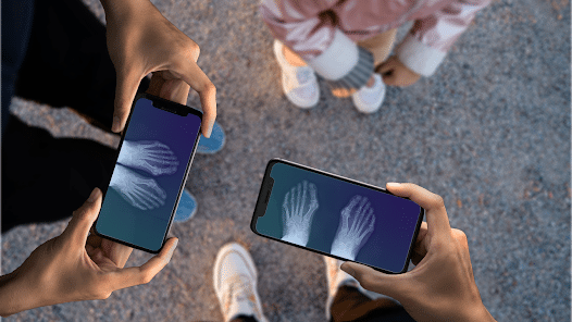 Aplicaciones Modernas de los Rayos X en Medicina